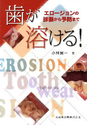 歯が溶ける! エロージョンの診断から予防まで 小林賢一/著 歯科学の本その他の商品画像
