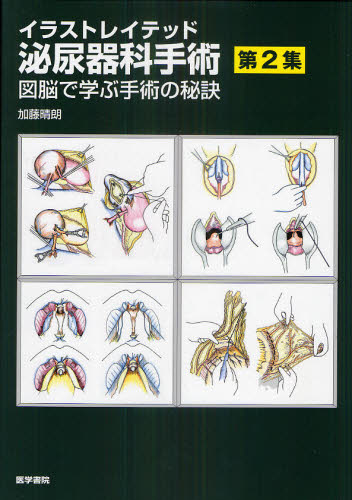 イラストレイテッド泌尿器科手術 第2集 (イラストレイテッド泌尿器科手術 2) 加藤晴朗/著 泌尿器科学の本の商品画像
