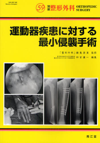 運動器疾患に対する最小侵襲手術 (別冊整形外科 No.59) 四宮謙一/編集