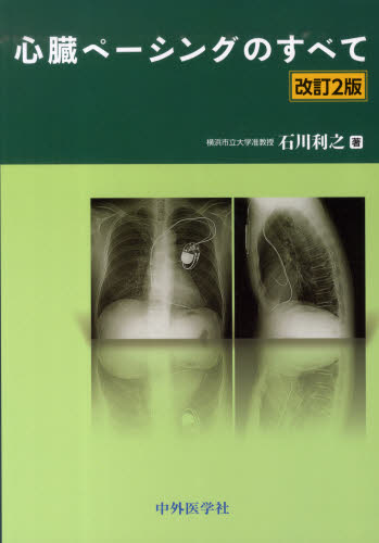 心臓ペーシングのすべて （改訂２版） 石川利之／著 心臓、血管外科学の本の商品画像