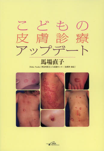 こどもの皮膚診療アップデート （第２版） 馬場直子／著 皮膚科学の本の商品画像