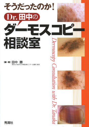 そうだったのか！Ｄｒ．田中のダーモスコピー相談室 （そうだったのか！） 田中勝／編・著 皮膚科学の本の商品画像