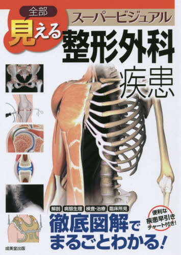 全部見える整形外科疾患 （スーパービジュアル） 高井信朗／監修 整形外科学の本の商品画像