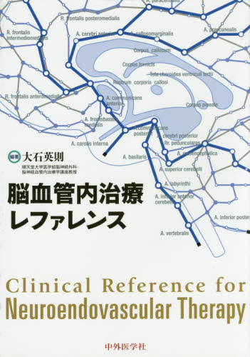 脳血管内治療レファレンス 大石英則／編著 脳神経科学、神経内科学の本の商品画像