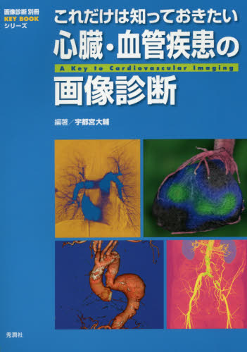これだけは知っておきたい心臓・血管疾患の画像診断 (画像診断別冊KEY BOOKシリーズ) 宇都宮大輔/編著 心臓、血管外科学の本の商品画像