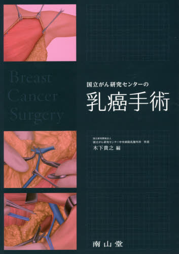 国立がん研究センターの乳癌手術 木下貴之／編 癌、腫瘍一般の本の商品画像