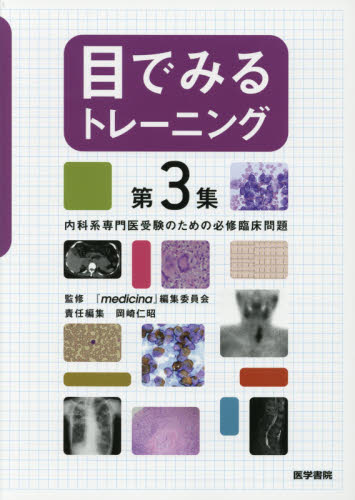 目でみるトレーニング 第3集 『medicina』編集委員会/監修 岡崎仁昭/責任編集 内科学一般の本の商品画像
