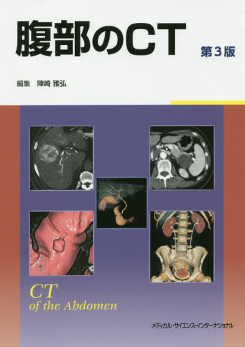 腹部のCT (第3版) 陣崎雅弘/編集 画像診断、超音波診断学の本の商品画像