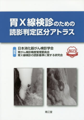 胃X線検診のための読影判定区分アトラス 日本消化器がん検診学会胃がん検診精度管理委員会胃X線検診の読影基準に関する研究会/編集 消化器一般の本の商品画像
