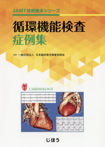 循環機能検査症例集 （ＪＡＭＴ技術教本シリーズ） 日本臨床衛生検査技師会／監修 心臓の本の商品画像