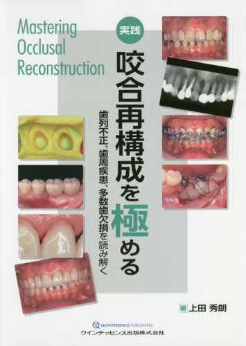 実践咬合再構成を極める 歯列不正、歯周疾患、多数歯欠損を読み解く