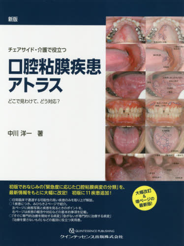 チェアサイド・介護で役立つ口腔粘膜疾患アトラス どこで見わけて、どう対応? (チェアサイド・介護で役立つ) (新版) 中川洋一/著 口腔外科学の本の商品画像