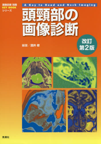 頭頸部の画像診断 （画像診断別冊ＫＥＹ　ＢＯＯＫシリーズ） （改訂第２版） 酒井修／編著 画像診断、超音波診断学の本の商品画像