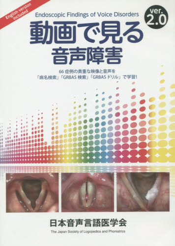 動画で見る音声障V2.0 DVD-ROM 日本音声言語医学会 耳鼻咽喉科、頭頸部外科学の本の商品画像
