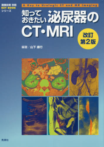 知っておきたい泌尿器のCT・MRI (画像診断別冊KEY BOOKシリーズ) (改訂第2版) 山下康行/編著 泌尿器科学の本の商品画像