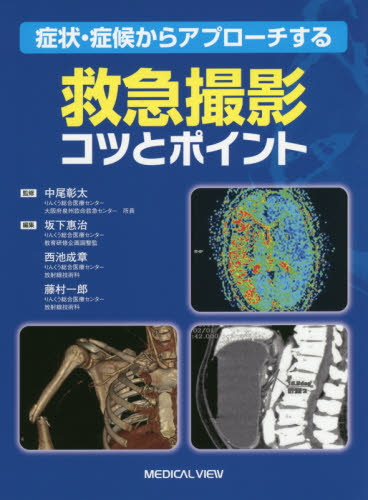 症状・症候からアプローチする救急撮影コツとポイント (症状・症候からアプローチする) 中尾彰太/監修 坂下惠治/編集 西池成章/編集 藤村一郎/編集 放射線診断学、核医学の本の商品画像