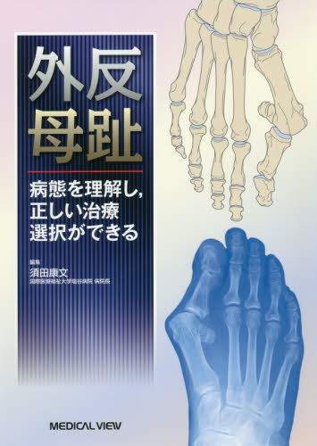 外反母趾　病態を理解し，正しい治療選択ができる 須田康文／編集 整形外科学の本の商品画像