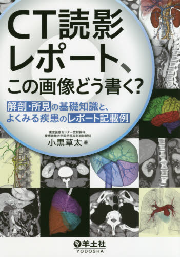CT読影レポート、この画像どう書く? 解剖・所見の基礎知識と、よくみる疾患のレポート記載例 小黒草太/著 画像診断、超音波診断学の本の商品画像