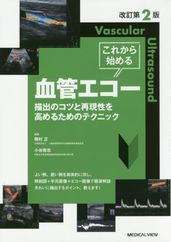これから始める血管エコー 描出のコツと再現性を高めるためのテクニック (改訂第2版) 種村正/編集 小谷敦志/編集 血管、血圧の本の商品画像