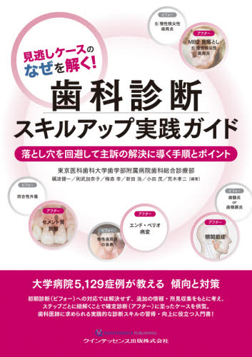 見逃しケースのなぜを解く!歯科診断スキルアップ実践ガイド 落とし穴を回避して主訴の解決に導く手順とポイント (見逃しケースのなぜを解く!) 礪波健一/編著 則武加奈子/編著 梅森幸/編著 新田浩/編著 小田茂/編著 荒木孝二/編著 臨床歯科学の本の商品画像