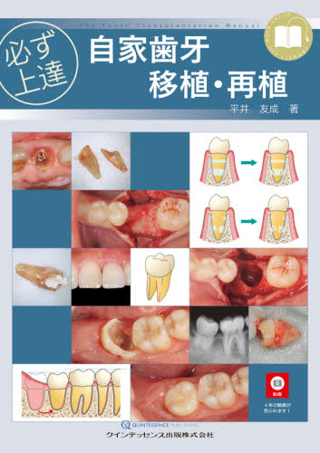 必ず上達自家歯牙移植・再植 （ＱＵＩＮＴ　ＫＩＣＫ－ＯＦＦ　ＬＩＢＲＡＲＹ） 平井友成／著 臨床歯科学の本の商品画像