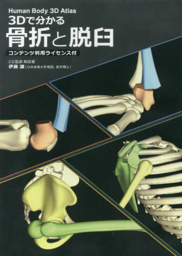 ３Ｄで分かる骨折と脱臼　Ｗｉｎｄｏｗｓ版 伊藤　譲 整形外科学の本の商品画像