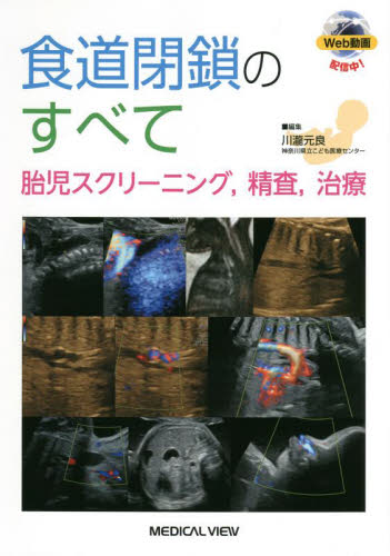 食道閉鎖のすべて 胎児スクリーニング,精査,治療 川瀧元良/編集 周産期医学(新生児学)の本の商品画像
