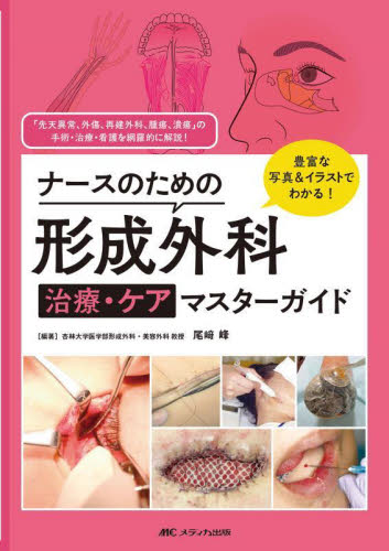 ナースのための形成外科治療・ケアマスターガイド 豊富な写真&イラストでわかる! 「先天異常、外傷、再建外科、腫瘍、潰瘍」の手術・治療・看護を網羅的に解説! 尾崎峰/編著 形成外科学の本の商品画像
