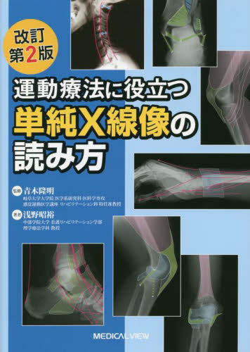 運動療法に役立つ単純X線像の読み方 (改訂第2版) 浅野昭裕/著 青木隆明/監修 リハビリテーション医学の本の商品画像