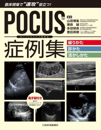 POCUS症例集撮りかた・診かた・活かしかた 臨床現場で“速攻”役立つ! 山田博胤/編 瀬良誠/編 多田明良/編 豊田英樹/編 画像診断、超音波診断学の本の商品画像