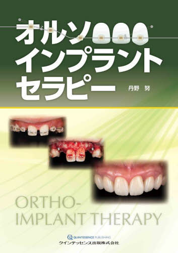 オルソインプラントセラピー 丹野努／著 臨床歯科学の本の商品画像