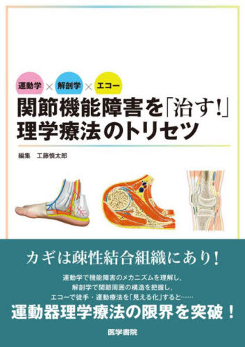 関節機能障害を「治す!」理学療法のトリセツ 運動学×解剖学×エコー 工藤慎太郎/編集 工藤慎太郎/〔ほか〕執筆 リハビリテーション医学の本の商品画像