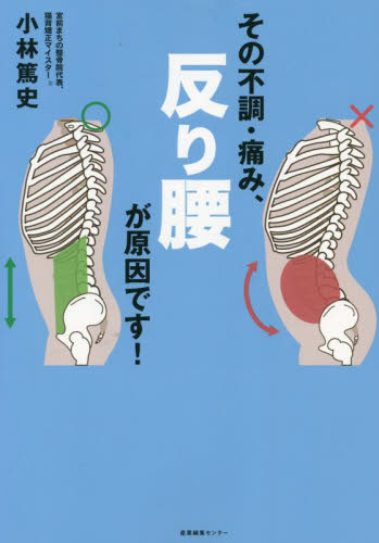 その不調・痛み、反り腰が原因です！ 小林篤史／著 家庭医学の本その他の商品画像