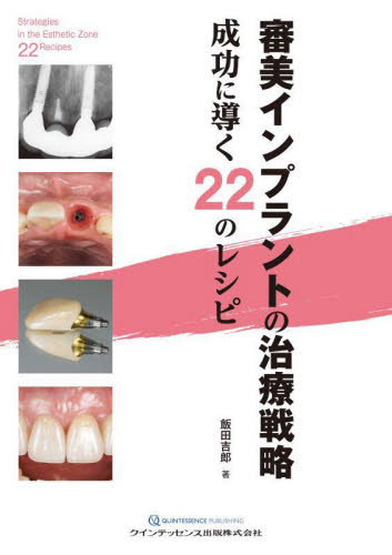 審美インプラントの治療戦略　成功に導く２２のレシピ 飯田吉郎／著 臨床歯科学の本の商品画像