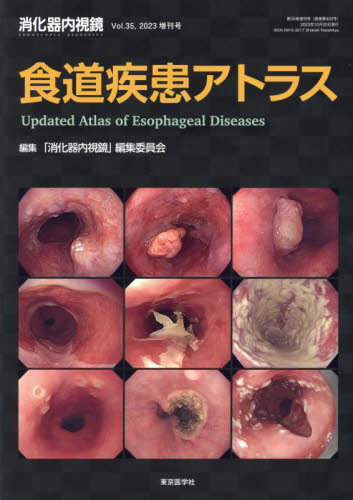 消化器内視鏡 Vol.35増刊号(2023) 消化器内視鏡編集委員会/編集 消化器一般の本の商品画像
