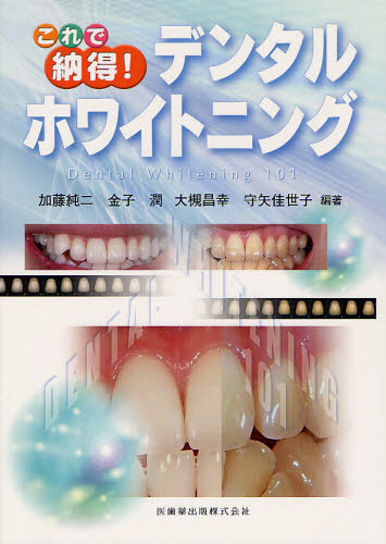 これで納得!デンタルホワイトニング Dental Whitening 101 加藤純二/編著 金子潤/編著 大槻昌幸/編著 守矢佳世子/編著 歯科学の本その他の商品画像