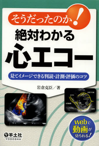 そうだったのか!絶対わかる心エコー 見てイメージできる判読・計測・評価のコツ 岩倉克臣/著 心電図、心音、心エコーの本の商品画像