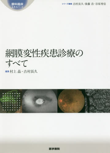 網膜変性疾患診療のすべて （眼科臨床エキスパート） 村上晶／編集