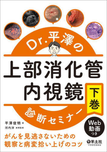Dr.平澤の上部消化管内視鏡診断セミナー がんを見逃さないための観察と病変拾い上げのコツ 下巻 平澤俊明/著 河内洋/病理監修 消化器一般の本の商品画像