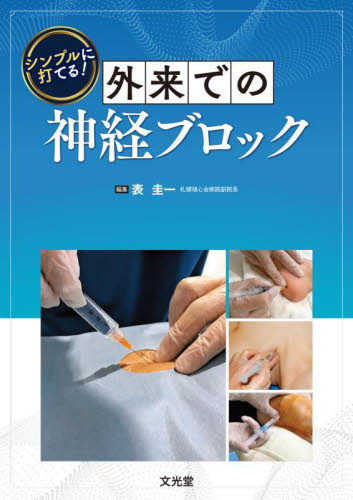 シンプルに打てる!外来での神経ブロック 表圭一/編集 麻酔科学、ペインクリニックの本の商品画像