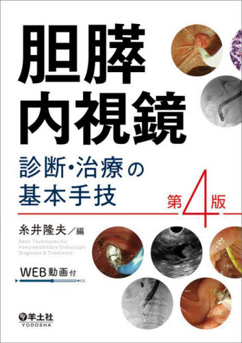 胆膵内視鏡診断・治療の基本手技 （第４版） 糸井隆夫／編 消化器一般の本の商品画像