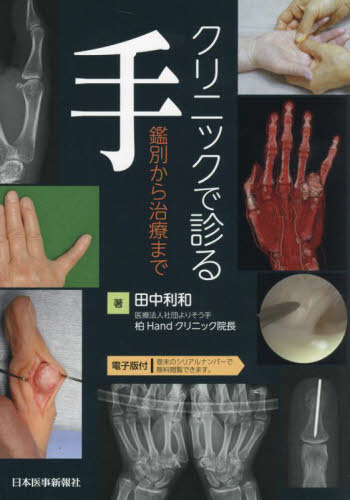 クリニックで診る手　鑑別から治療まで 田中利和／著 整形外科学の本の商品画像