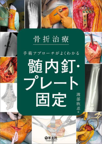 スタンダード骨折手術治療 上肢」 編集 渡部欣忍 スタンダード骨折手術