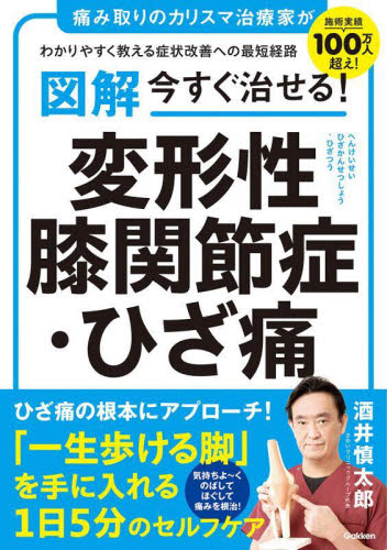 図解今すぐ治せる！変形性膝関節症・ひざ痛　痛み取りのカリスマ治療家がわかりやすく教える症状改善への最短経路 酒井慎太郎／著 各科別療法の本の商品画像