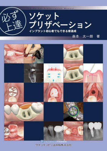 必ず上達ソケットプリザベーション インプラント初心者でもできる骨造成 森本太一朗/著 臨床歯科学の本の商品画像