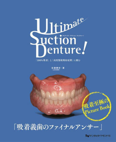 Ｕｌｔｉｍａｔｅ　Ｓｕｃｔｉｏｎ　Ｄｅｎｔｕｒｅ！　「１００％吸着」と「高度顎堤吸収症例」に挑む 佐藤勝史／著 臨床歯科学の本の商品画像