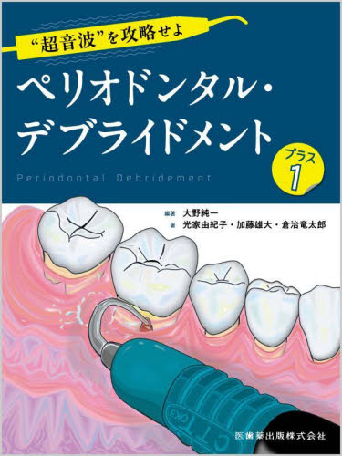 “超音波”を攻略せよペリオドンタル・デブライドメント プラス1 大野純一/編著 光家由紀子/著 加藤雄大/著 倉治竜太郎/著 基礎歯科学の本の商品画像