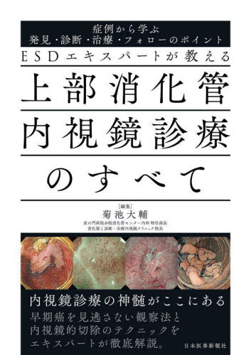 ESDエキスパートが教える上部消化管内視鏡診療のすべて 症例から学ぶ発見・診断・治療・フォローのポイント 菊池大輔/編集 消化器一般の本の商品画像