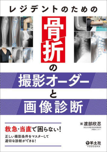 レジデントのための骨折の撮影オーダーと画像診断 救急・当直で困らない!正しい撮影条件をマスターして適切な診断ができる! 渡部欣忍/編 画像診断、超音波診断学の本の商品画像
