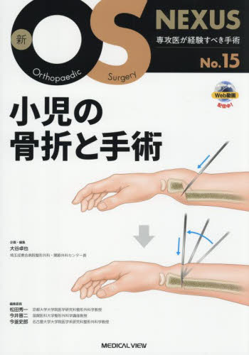 小児の骨折と手術 (新OS NEXUS No.15) 大谷卓也/企画・編集 整形外科学の本の商品画像